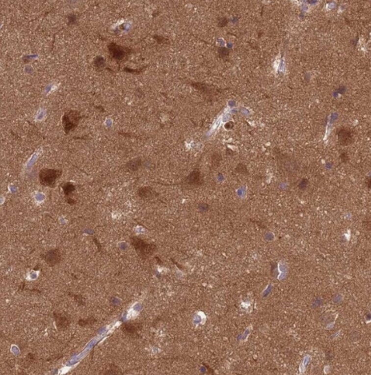 PP2A alpha Antibody - BSA Free
