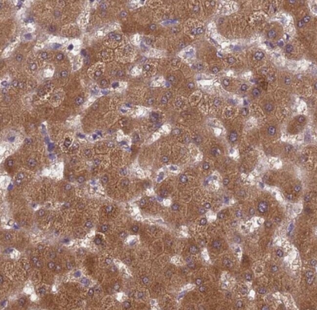 PP2A alpha Antibody - BSA Free
