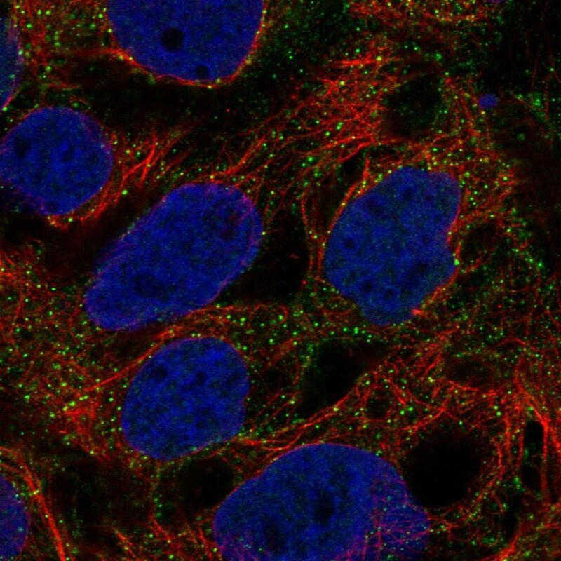 HSP70/HSPA1A Antibody - BSA Free Immunocytochemistry/Immunofluorescence: HSP70/HSPA1A Antibody [NBP2-46806]