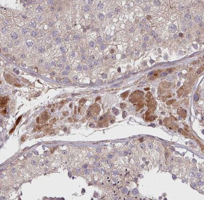 TWEAK/TNFSF12 Antibody