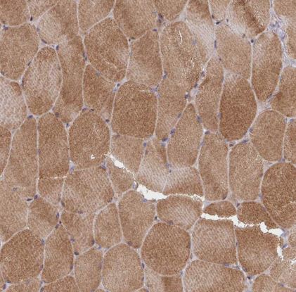 TWEAK/TNFSF12 Antibody