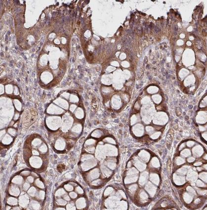 TWEAK/TNFSF12 Antibody