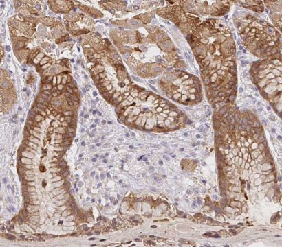 CaM Kinase II alpha Antibody