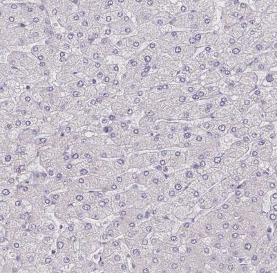 CaM Kinase II alpha Antibody