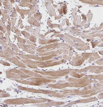 CaM Kinase II alpha Antibody