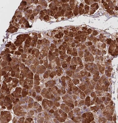 Trypsin 1/PRSS1 Antibody