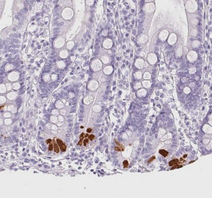 Trypsin 1/PRSS1 Antibody