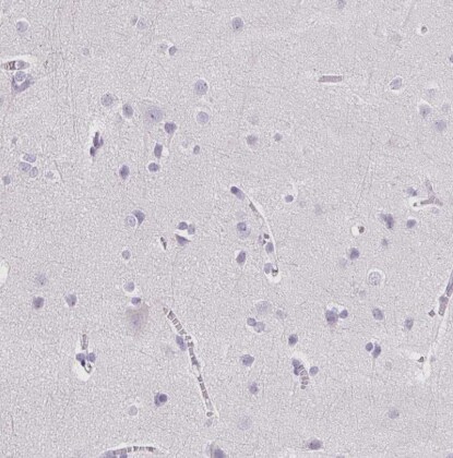 Trypsin 1/PRSS1 Antibody