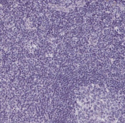 Trypsin 1/PRSS1 Antibody