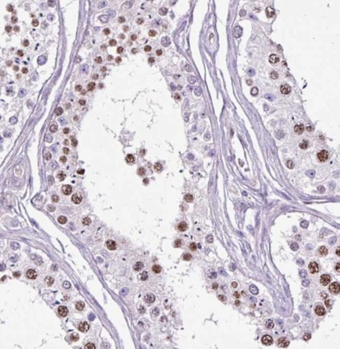 SPC24 Antibody - BSA Free