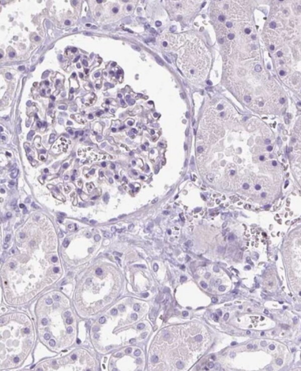 SPC24 Antibody - BSA Free