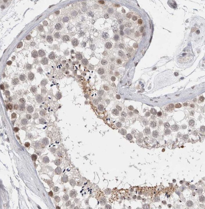 RECQL4 Antibody - BSA Free