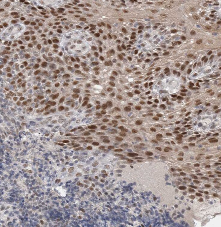RECQL4 Antibody - BSA Free