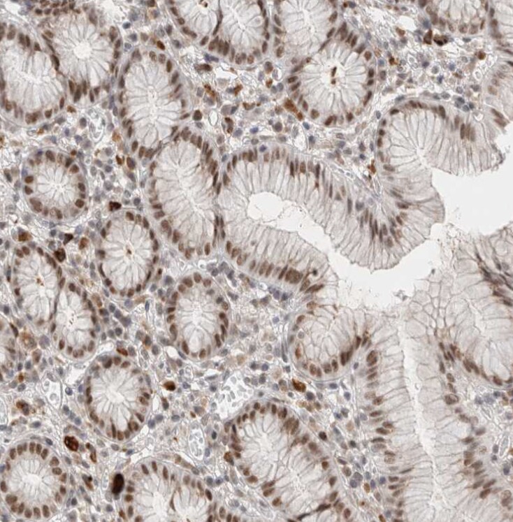 RECQL4 Antibody - BSA Free