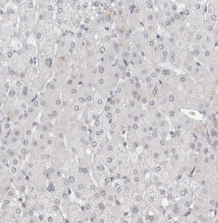 RECQL4 Antibody - BSA Free
