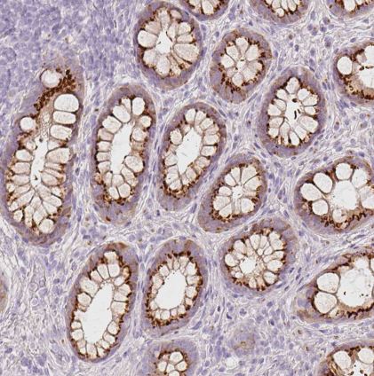 PDXDC1 Antibody