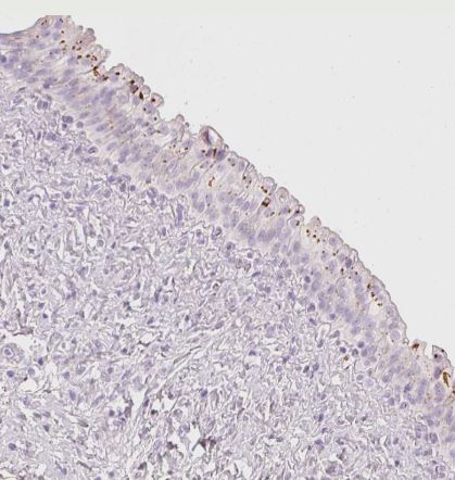 PDXDC1 Antibody