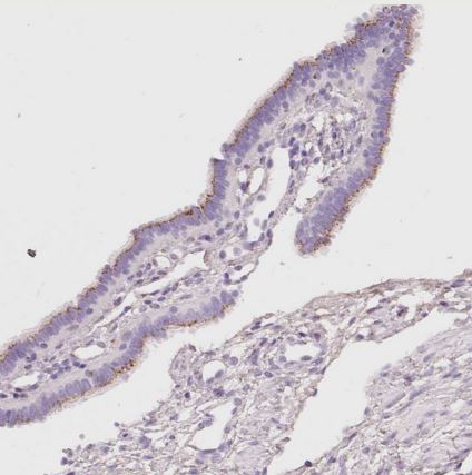 PDXDC1 Antibody