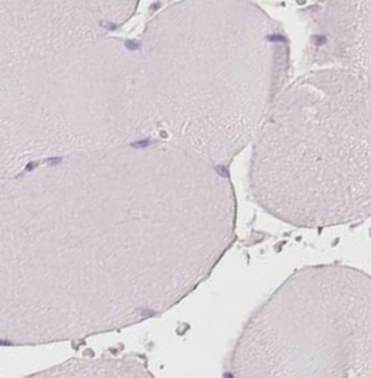 PDXDC1 Antibody