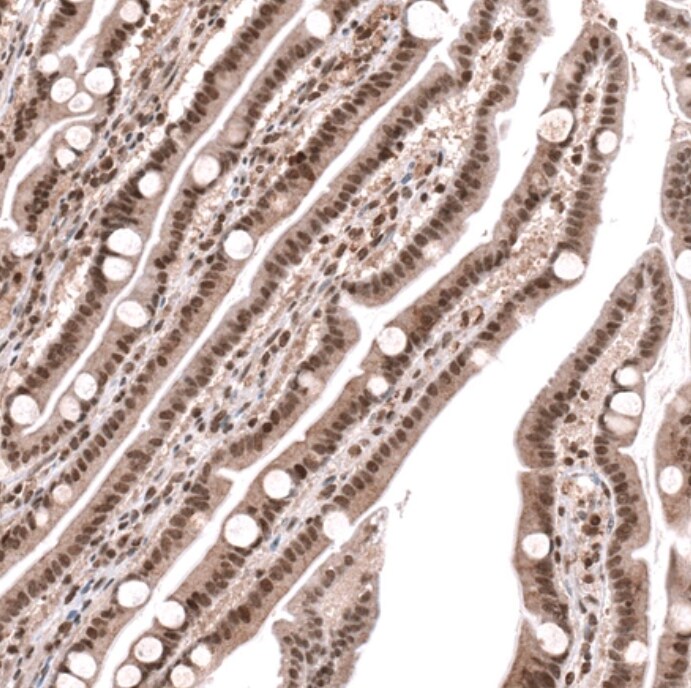 PARP2 Antibody - BSA Free