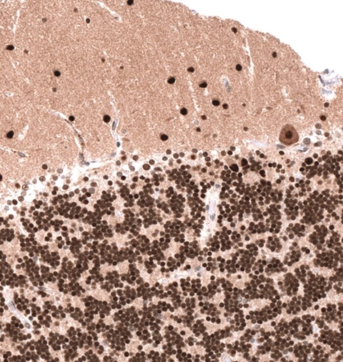 PARP2 Antibody - BSA Free