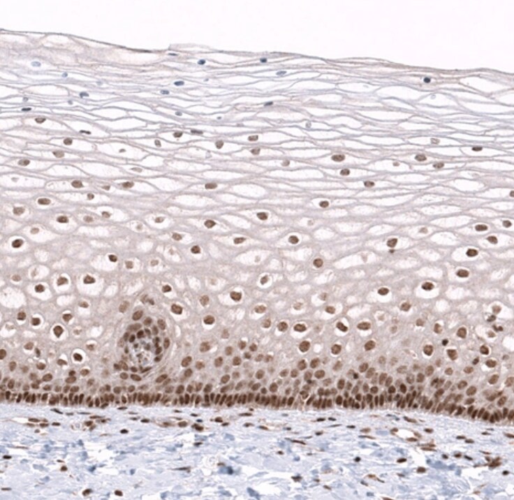 PARP2 Antibody - BSA Free