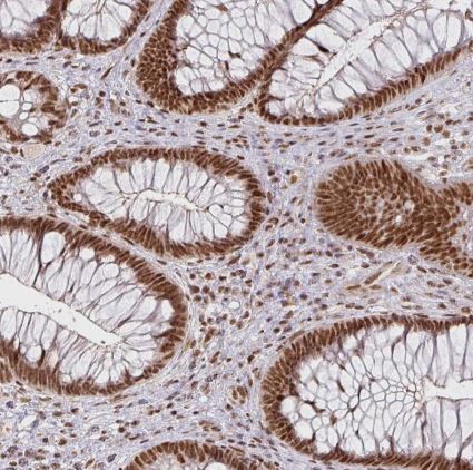 NCOA5 Antibody