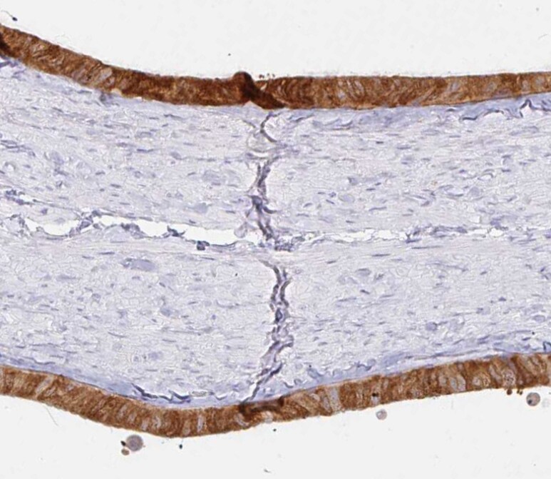 Derlin-2 Antibody - BSA Free