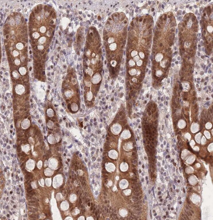DEAF1 Antibody - BSA Free