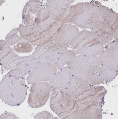 UBXN7 Antibody