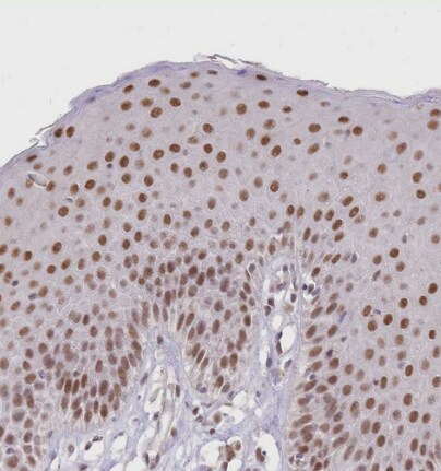 UBXN7 Antibody