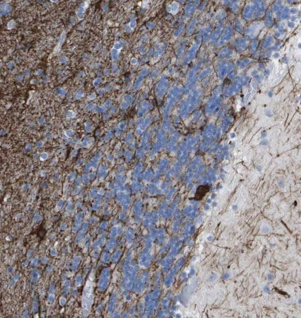 Kv1.3 Antibody