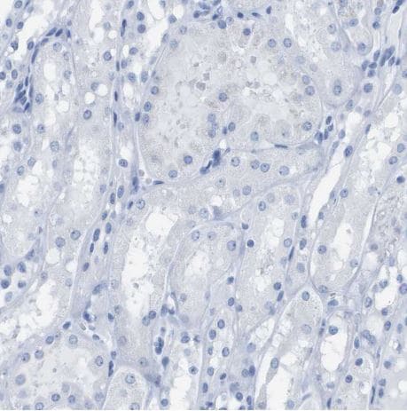Kv1.3 Antibody