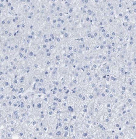 Kv1.3 Antibody