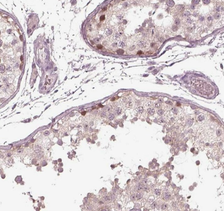CCDC170 Antibody - BSA Free