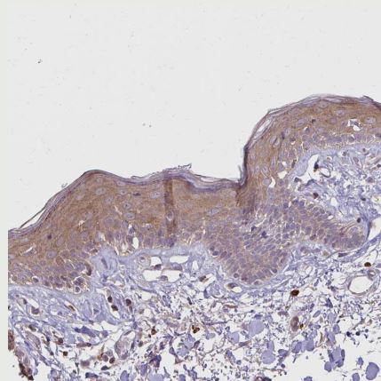 Desmoplakin Antibody