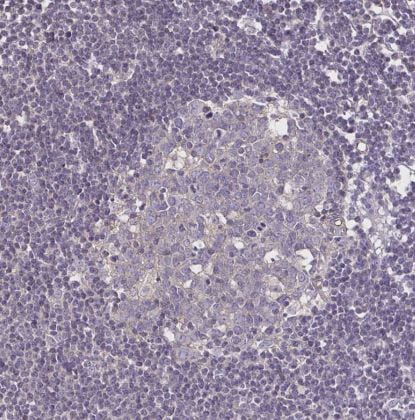 Desmoplakin Antibody