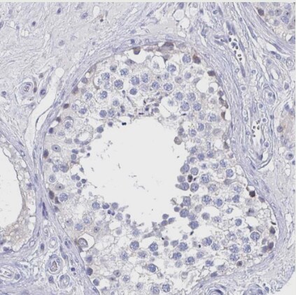 EBI3 Antibody