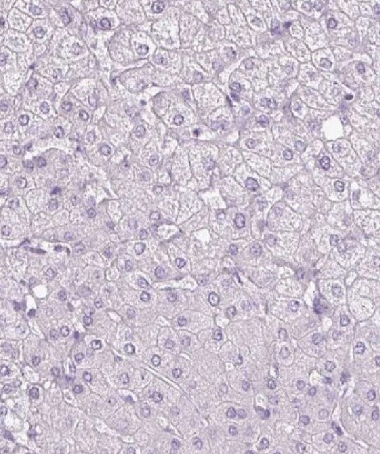 Reg3A Antibody - BSA Free
