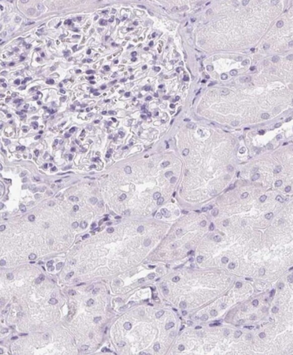 Reg3A Antibody - BSA Free