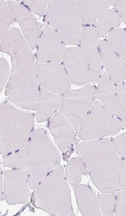 Reg3A Antibody - BSA Free