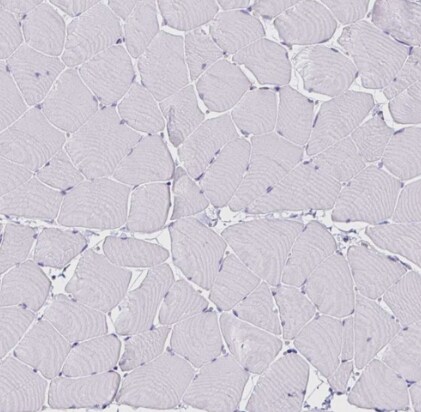 VSIG2 Antibody