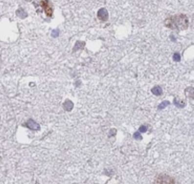 NDUFAF6 Antibody - BSA Free