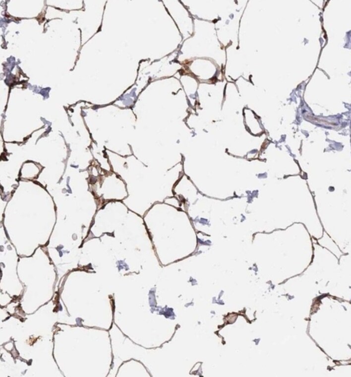 TUSC5 Antibody - BSA Free