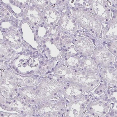 Secretin Antibody - BSA Free