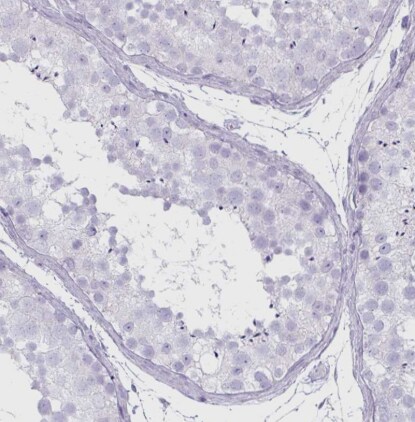 CLCA1 Antibody