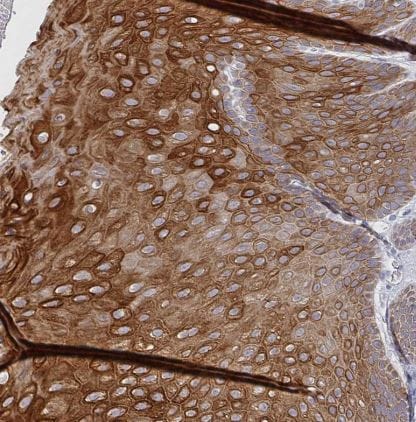 RhoV Antibody