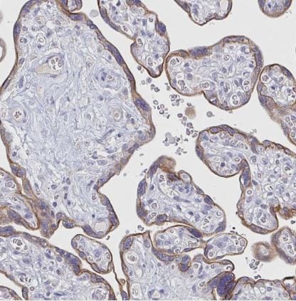 RhoV Antibody