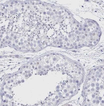 RhoV Antibody