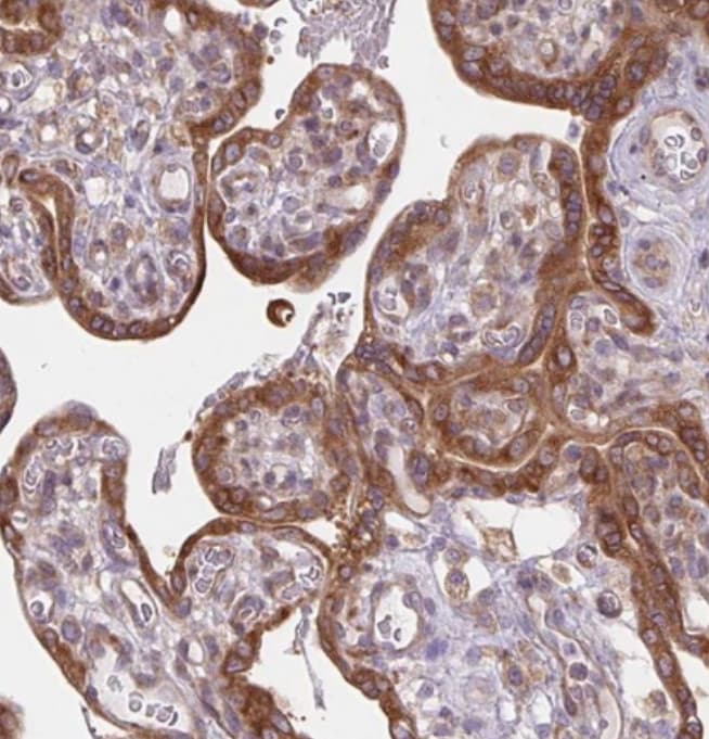 MAP4K6 Antibody - BSA Free